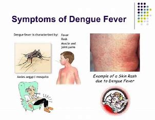 Dengue Fever: Symptoms, Diagnosis, and Prevention Tips