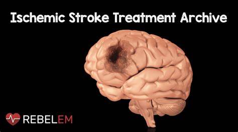 World Stroke Day 2023: Understanding Strokes, Their Treatment, and Prevention Methods